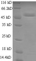 Human Cytochrome b-c1 complex subunit Rieske, mitochondrial (UQCRFS1) Recombinant Protein, Homo sapiens (Human), E.coli, N-terminal GST-tagged, 48.6 kDa, purity >≥ 90% as determined by SDS-PAGE.