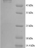 Human 6-phosphogluconate dehydrogenase, decarboxylating (PGD), partial Recombinant Protein - BioCrest Sci