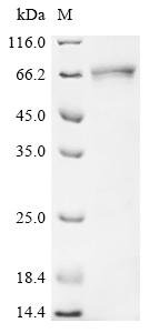 Human Elastin (ELN) Recombinant Protein, Homo sapiens (Human), E.coli, N-terminal 10xHis-tagged and C-terminal Myc-tagged, 70.9 kDa, purity >≥ 85% as determined by SDS-PAGE.