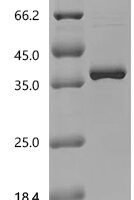 Rat NAD-dependent protein deacylase sirtuin-5, mitochondrial (Sirt5) Recombinant Protein - BioCrest Sci