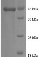 Human Prefoldin subunit 5 (PFDN5) Recombinant Protein - BioCrest Sci