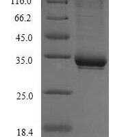 Human T-cell surface glycoprotein CD1c (CD1C), partial Recombinant Protein, N-His - BioCrest Sci
