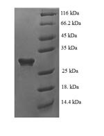 Human Glial cell line-derived neurotrophic factor (GDNF) Recombinant Protein, N-His-SUMO, Homo sapiens (Human), E.coli, N-terminal 6xHis-SUMO-tagged, 31.1 kDa, purity >≥ 90% as determined by SDS-PAGE.