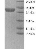 Dog Matrix metalloproteinase-9 (MMP9) Recombinant Protein - BioCrest Sci