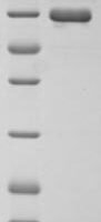Human Endogenous retrovirus group K member 6 Env polyprotein (ERVK-6), partial Recombinant Protein, N-His, aa 90–632, Yeast - BioCrest Sci