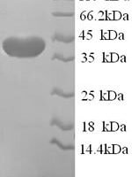 Human ELAV-like protein 2 (ELAVL2), partial Recombinant Protein, N-His, aa 4–356, Yeast - BioCrest Sci