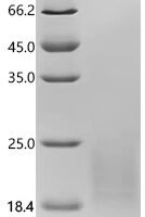 Human SH3 and multiple ankyrin repeat domains protein 3 (SHANK3), partial Recombinant Protein, C-10His - BioCrest Sci