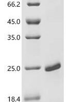 Human papillomavirus type 53  Protein E7 (E7) Recombinant Protein - BioCrest Sci