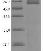 Human Tryptophan 2,3-dioxygenase (TDO2) Recombinant Protein, N-His-SUMO - BioCrest Sci