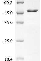 Human Kit ligand (KITLG), partial Recombinant Protein, C-hFc1-Myc - BioCrest Sci