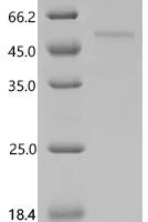 Human Interleukin-13 receptor subunit alpha-2 (IL13RA2), partial Recombinant Protein - BioCrest Sci
