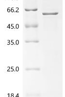 Mouse Thioredoxin-interacting protein (Txnip), partial Recombinant Protein - BioCrest Sci