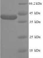 Human ATP-sensitive inward rectifier potassium channel 10 (KCNJ10), partial Recombinant Protein - BioCrest Sci