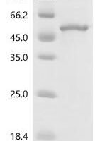 Human Dual specificity protein phosphatase 4 (DUSP4) Recombinant Protein - BioCrest Sci