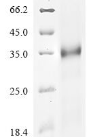 Severe acute respiratory syndrome coronavirus 2 Spike glycoprotein (S) (L452Q,F490S), partial Recombinant Protein, N-10His/C-Myc - BioCrest Sci