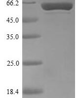 Thermus aquaticus DNA polymerase I, thermostable (polA), partial Recombinant Protein, N-His, aa 289–832, Yeast - BioCrest Sci