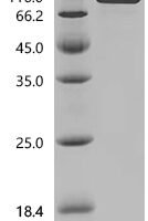 Mouse Interleukin-13 receptor subunit alpha-1 (Il13ra1), partial Recombinant Protein - BioCrest Sci