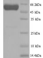 Human Septin-7 (SEPTIN7) Recombinant Protein, N-His - BioCrest Sci