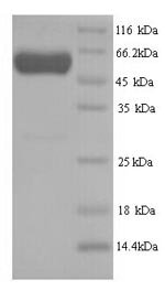 Human Septin-7 (SEPTIN7) Recombinant Protein, N-His, Homo sapiens (Human), Yeast, N-terminal 6xHis-tagged, 52.5 kDa, purity >≥ 90% as determined by SDS-PAGE.