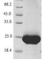 Human Ras-related protein Rab-10 (RAB10), partial Recombinant Protein - BioCrest Sci
