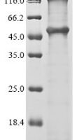 Human Melanoma-associated antigen 12 (MAGEA12) Recombinant Protein - BioCrest Sci