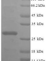 Human 39S ribosomal protein L20, mitochondrial (MRPL20), partial Recombinant Protein - BioCrest Sci