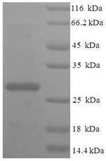 Human 39S ribosomal protein L20, mitochondrial (MRPL20), partial Recombinant Protein, Homo sapiens (Human), E.coli, N-terminal 6xHis-SUMO-tagged, 27.8 kDa, purity >≥ 90% as determined by SDS-PAGE.