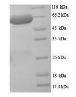 Rat Putative phospholipase B-like 2 (Plbd2) Recombinant Protein, N-His, Rattus norvegicus (Rat), Yeast, N-terminal 6xHis-tagged, 63.9 kDa, purity >≥ 90% as determined by SDS-PAGE.