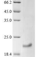 Human Troponin C, slow skeletal and cardiac muscles (TNNC1) Recombinant Protein - BioCrest Sci