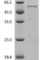 Human Transmembrane protease serine 4 (TMPRSS4), partial Recombinant Protein, C-His - BioCrest Sci