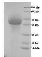 Human rhinovirus A serotype 89 Genome polyprotein, partial Recombinant Protein - BioCrest Sci