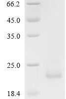 Human Early activation antigen CD69 (CD69), partial Recombinant Protein, N-His - BioCrest Sci