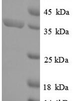 Escherichia coli 4-hydroxy-tetrahydrodipicolinate synthase (dapA) Recombinant Protein - BioCrest Sci