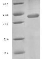 Human Excitatory amino acid transporter 4 (SLC1A6), partial Recombinant Protein - BioCrest Sci