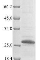 Mouse Sclerostin domain-containing protein 1 (Sostdc1) Recombinant Protein, N-10His/C-Myc - BioCrest Sci