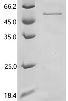 Clostridioides difficile Cell wall-binding cysteine protease Cwp84 (lytC_12), partial Recombinant Protein - BioCrest Sci