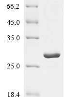 Human cytomegalovirus Envelope glycoprotein H (gH), partial Recombinant Protein - BioCrest Sci