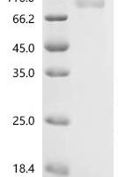 Human Sodium/potassium-transporting ATPase subunit alpha-1 (ATP1A1), partial, Biotinylated Recombinant Protein - BioCrest Sci
