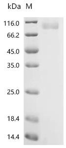 Human Sodium/potassium-transporting ATPase subunit alpha-1 (ATP1A1), partial, Biotinylated Recombinant Protein, Homo sapiens (Human), Mammalian cell, N-terminal hFc1-Avi-tagged, 74.9 kDa, purity >≥ 85% as determined by SDS-PAGE.