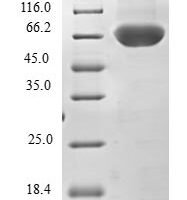 Human Tripartite motif-containing protein 69 (TRIM69) Recombinant Protein - BioCrest Sci