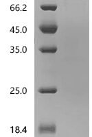 Human Interferon alpha/beta receptor 1 (IFNAR1), partial Recombinant Protein, C-hFc1 - BioCrest Sci