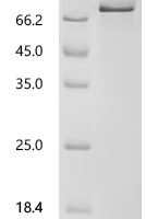 Mouse Growth arrest-specific protein 6 (Gas6) Recombinant Protein, C-10His, aa 28–674, Baculovirus - BioCrest Sci