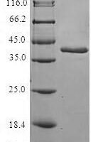 Human Retinol-binding protein 2 (RBP2) Recombinant Protein - BioCrest Sci