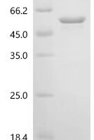 Human Casein kinase I isoform delta (CSNK1D) Recombinant Protein, N-10His - BioCrest Sci
