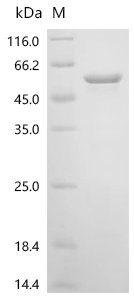 Human Casein kinase I isoform delta (CSNK1D) Recombinant Protein, N-10His, Homo sapiens (Human), E.coli, N-terminal 10xHis-tagged, 53.4 kDa, purity >≥ 90% as determined by SDS-PAGE.