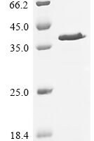 Saccharomyces cerevisiae Actin-related protein 5 (ARP5), partial Recombinant Protein - BioCrest Sci