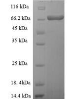 Yersinia pestis 60 kDa chaperonin (groL) Recombinant Protein, N-His-SUMO - BioCrest Sci