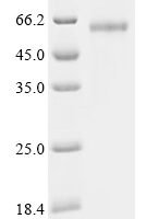 Human C-type lectin domain family 4 member G (CLEC4G), partial Recombinant Protein, N-hFc - BioCrest Sci