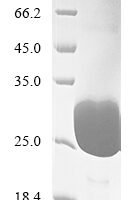 Human Gastrin-releasing peptide (GRP), partial Recombinant Protein - BioCrest Sci