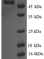 Saccharomyces cerevisiae Cystathionine gamma-lyase (CYS3), partial Recombinant Protein - BioCrest Sci